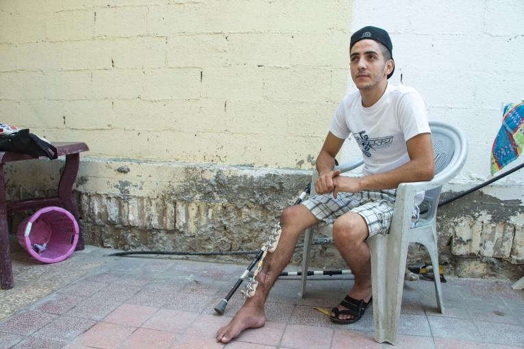 Eyad un Palestinien de 22 ans blessé le 14 mai 2018. Gaza.