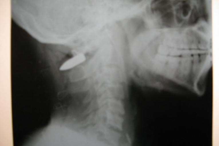 La recrudescence des affrontements fait de nombreuses victimes par balle