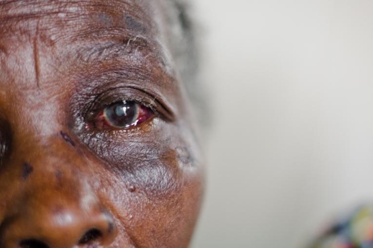 Cette femme de 70 ans a été victime de violences sexuelles. Ses voisins l'ont amenée au centre de santé de Biakoto où elle a pu recevoir des soins médicaux et psychologiques.