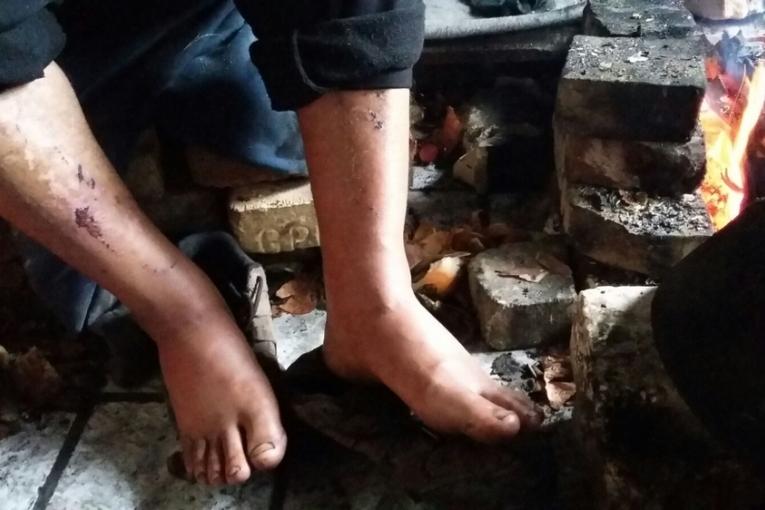 « Ils ont confisqué mes chaussures et m'ont forcé à rester debout dans la neige pendant une heure » MSF Mars 2017