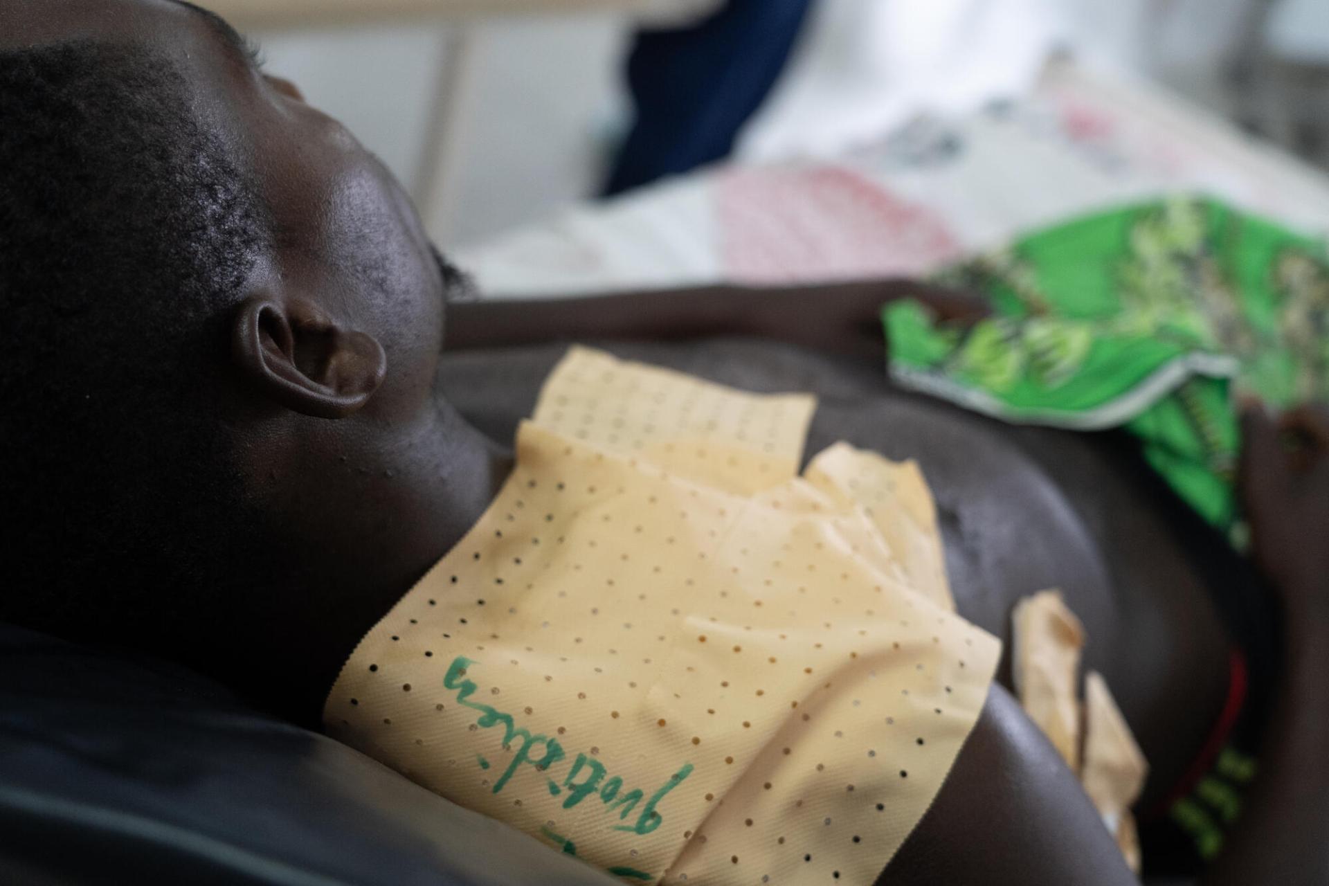 Un chirurgien MSF (à gauche) fait sa visite quotidienne auprès des patients de l’hôpital général de Rutshuru. Un jeune homme (droite) est pris en charge dans le même hôpital. Il a été blessé par balle alors qu’il travaillait dans les champs d’une localité voisine. Nord-Kivu, RDC, août 2025.