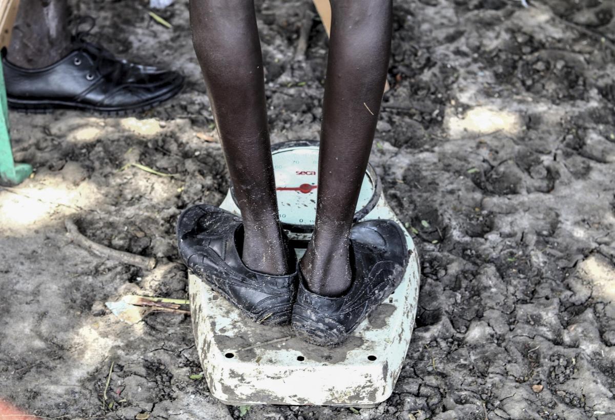 Un garçon se pèse pendant une consultation auprès d'une clinique mobile MSF à Lanyeri payam. 
 © Tetiana Gaviuk/MSF