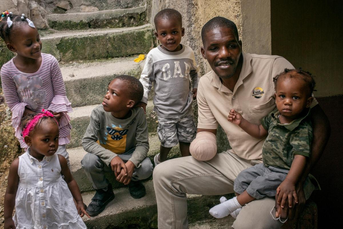 Wilfrid a été victime d'un coup de machette dans le quartier de Tabarre en octobre 2020. Des membres d'un gang l'ont attaqué alors qu'il était à moto. Son métier était tailleur et il ne peut plus travailler. Lui et sa famille ont dû déménager pour habiter dans un quartier plus sûr. Il a été pris en charge et suivi par les équipes MSF de Tabarre. Haïti.
 © Guillaume Binet/MYOP