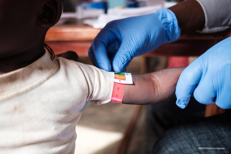 Un enfant est en train de se faire dépister pour la malnutrition par les équipes MSF. Nigeria. 2020. 
 © Abayomi Akande