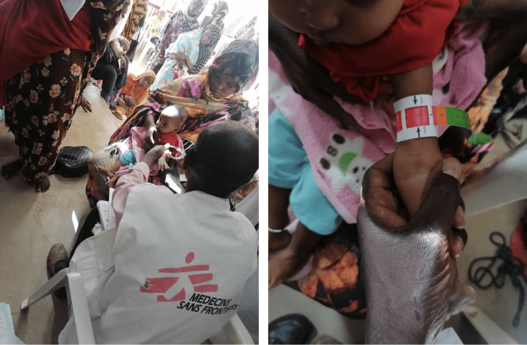Dans le camp de Zamzam, au Soudan, MSF fait face à une crise de malnutrition catastrophique.
 
 
 
 