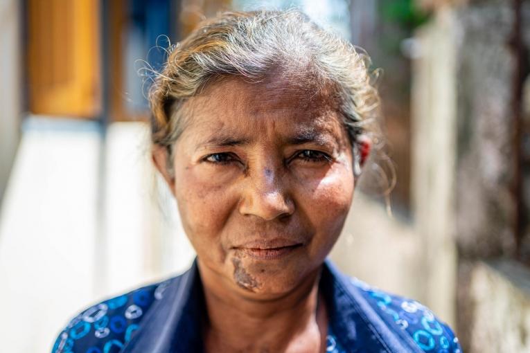 Daw Than Than est veuve depuis 10 ans et a du mal à gagner sa vie. Myanmar. 2022.
 © Ben Small/MSF