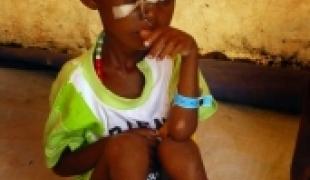 Certains enfants sévèrement malnutris ont besoin d'être nourris par sonde naso gastrique