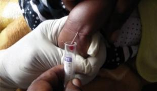 En 2010 MSF traite près de 160 000 patients VIH/sida dans une vingtaine de pays. Pour continuer à mettre sous traitement le plus grand nombre de personnes la lutte contre cette maladie passe plus que jamais par une simplification de la prise en charge d