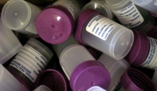 Entretien avec le docteur Christophe Fournier président du Conseil international de MSF.