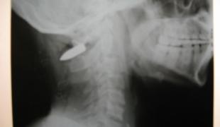 La recrudescence des affrontements fait de nombreuses victimes par balle